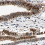 SELENBP1 Antibody in Immunohistochemistry (IHC)