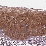 FAM115A Polyclonal Antibody