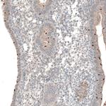 NPRL3 Antibody in Immunohistochemistry (IHC)