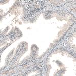 NPRL3 Antibody in Immunohistochemistry (IHC)