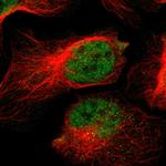 NAV2 Polyclonal Antibody