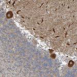 NAV2 Antibody in Immunohistochemistry (Paraffin) (IHC (P))