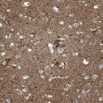 CNTNAP1 Antibody in Immunohistochemistry (Paraffin) (IHC (P))