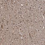 SEZ6 Antibody in Immunohistochemistry (IHC)