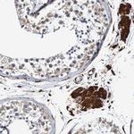 TMEM109 Antibody in Immunohistochemistry (Paraffin) (IHC (P))