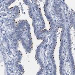 WBP5 Antibody in Immunohistochemistry (Paraffin) (IHC (P))