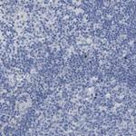 WBP5 Antibody in Immunohistochemistry (Paraffin) (IHC (P))