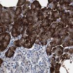 WBP5 Antibody in Immunohistochemistry (Paraffin) (IHC (P))