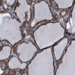 WBP5 Antibody in Immunohistochemistry (IHC)