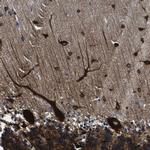 LRIG1 Antibody in Immunohistochemistry (IHC)