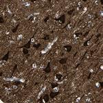 LRIG1 Antibody in Immunohistochemistry (IHC)