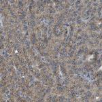 ACBD5 Antibody in Immunohistochemistry (IHC)