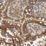 PCDH7 Antibody in Immunohistochemistry (IHC)