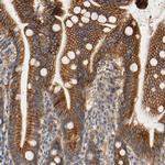 PCDH7 Antibody in Immunohistochemistry (IHC)