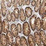 PCDH7 Antibody in Immunohistochemistry (IHC)