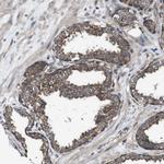 BTN3A3 Polyclonal Antibody