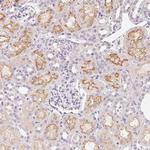 SLC6A18 Antibody in Immunohistochemistry (Paraffin) (IHC (P))