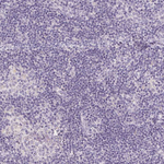 SLC6A18 Polyclonal Antibody