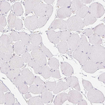 SLC6A18 Antibody in Immunohistochemistry (Paraffin) (IHC (P))