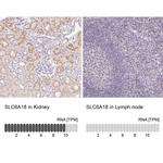 SLC6A18 Antibody in Immunohistochemistry (IHC)