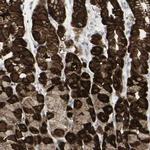 SARG Antibody in Immunohistochemistry (IHC)