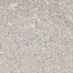 SARG Antibody in Immunohistochemistry (IHC)