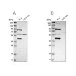 SARG Antibody in Western Blot (WB)