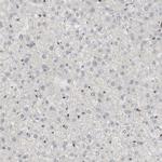 SARG Antibody in Immunohistochemistry (IHC)