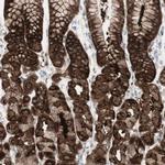 SARG Antibody in Immunohistochemistry (IHC)