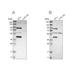 SARG Antibody in Western Blot (WB)