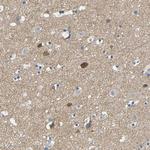 NEGR1 Antibody in Immunohistochemistry (Paraffin) (IHC (P))