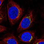 RNF24 Polyclonal Antibody