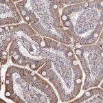 RNF24 Antibody in Immunohistochemistry (Paraffin) (IHC (P))