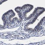 PDLIM4 Antibody in Immunohistochemistry (Paraffin) (IHC (P))