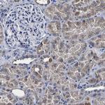 PDLIM4 Antibody in Immunohistochemistry (Paraffin) (IHC (P))