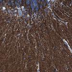 IGSF8 Antibody in Immunohistochemistry (Paraffin) (IHC (P))