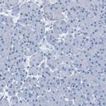 IGSF8 Polyclonal Antibody
