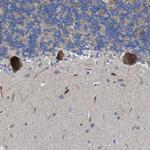 CCDC90B Antibody in Immunohistochemistry (Paraffin) (IHC (P))