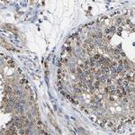 CCDC90B Antibody in Immunohistochemistry (IHC)