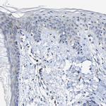 CCDC90B Antibody in Immunohistochemistry (IHC)