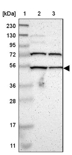EFCAB14 Antibody in Western Blot (WB)