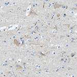 SorCS1 Antibody in Immunohistochemistry (Paraffin) (IHC (P))