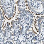 SorCS1 Antibody in Immunohistochemistry (Paraffin) (IHC (P))