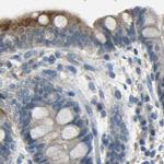 STBD1 Antibody in Immunohistochemistry (IHC)