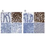 ASGR1 Antibody in Immunohistochemistry (IHC)