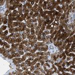 ASGR1 Antibody in Immunohistochemistry (IHC)