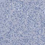 ASGR1 Antibody in Immunohistochemistry (IHC)