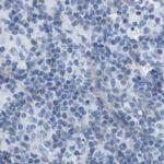 ASGR1 Antibody in Immunohistochemistry (IHC)