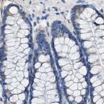 ASGR1 Antibody in Immunohistochemistry (IHC)