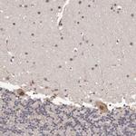 PRR12 Antibody in Immunohistochemistry (Paraffin) (IHC (P))
